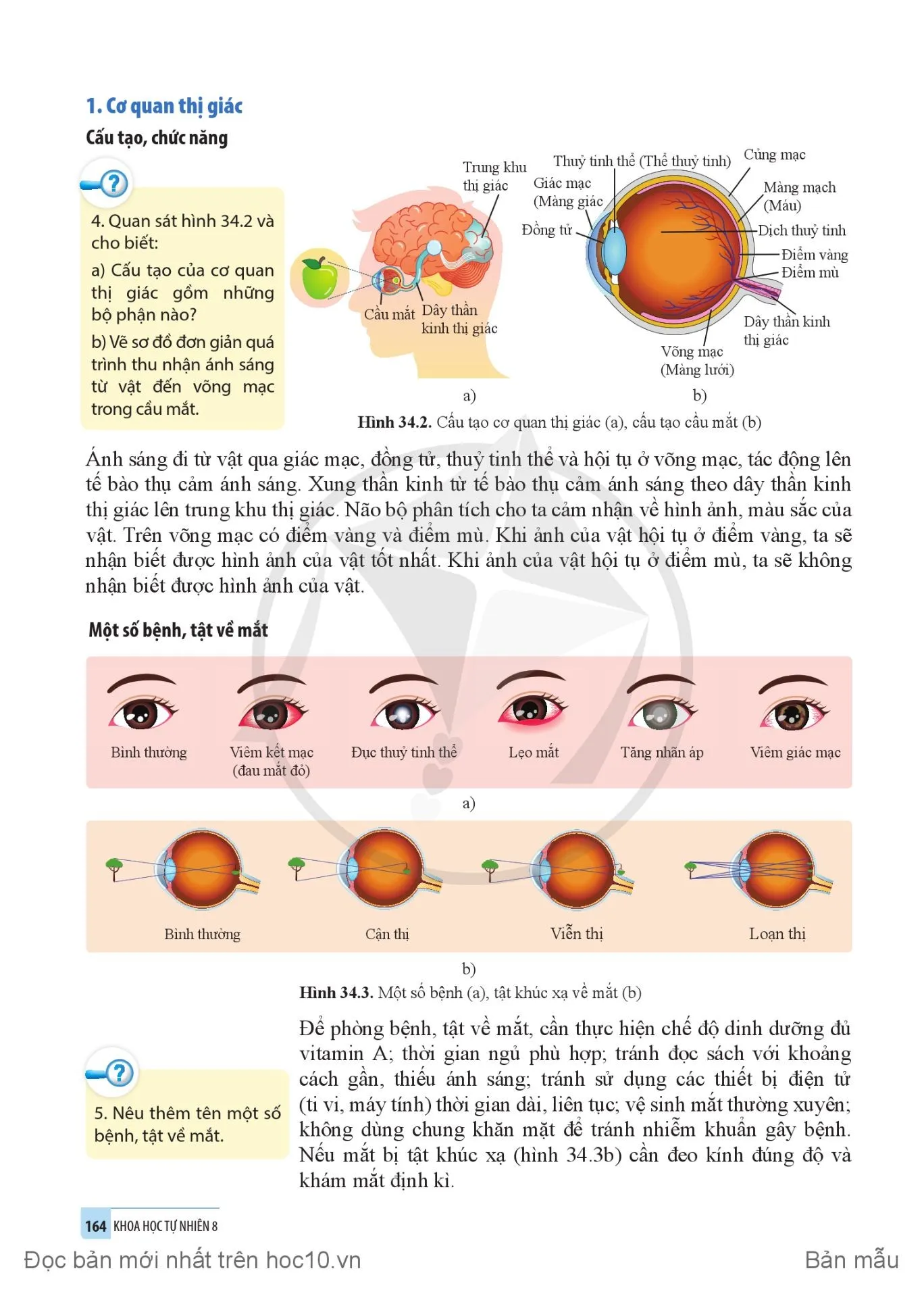 34. Hệ thần kinh và các giác quan ở người