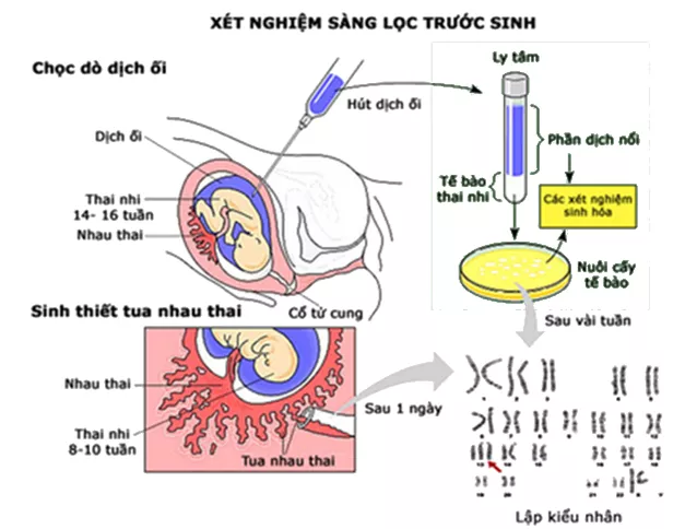 Lý thuyết Sinh học 12 Bài 22: Bảo vệ vốn gen của loài người và một số vấn đề xã hội của di truyền học | Lý thuyết Sinh học 12 đầy đủ, chi tiết nhất Ly Thuyet Bao Ve Von Gen Cua Loai Nguoi Va Mot So Van De Xa Hoi Cua Di Truyen Hoc