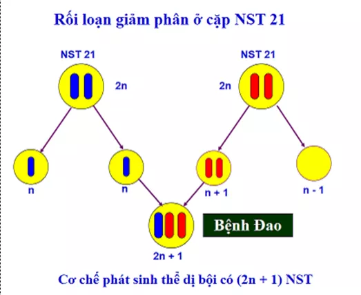 Lý thuyết Sinh học 12 Bài 21: Di truyền y học | Lý thuyết Sinh học 12 đầy đủ, chi tiết nhất Ly Thuyet Di Truyen Y Hoc 2