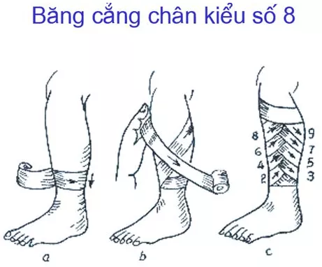 Nêu các loại băng và kĩ thuật các kiểu băng cơ bản Neu Cac Loai Bang Va Ki Thuat Cac Kieu Bang Co Ban