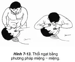 Phương pháp thổi ngạt và ép tim ngoài lồng ngực Phuong Phap Thoi Ngat Va Ep Tim Ngoai Long Nguc
