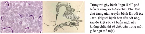 Sưu tầm thông tin, tranh ảnh về một số bệnh do nguyên sinh vật gây nên  Suu Tam Thong Tin Tranh Anh Ve Mot So Benh Do Nguyen Sinh Vat 3