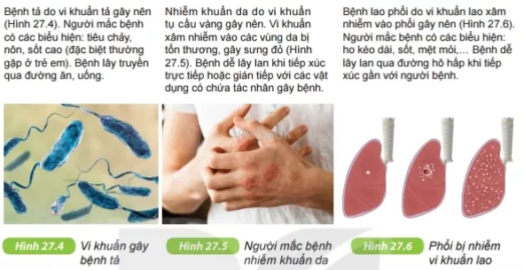 Dựa vào các thông tin trên, em hãy nêu một số biện pháp để phòng bệnh do vi khuẩn Cau Hoi 5 Trang 94 Bai 27 Khoa Hoc Tu Nhien Lop 6 Ket Noi 1