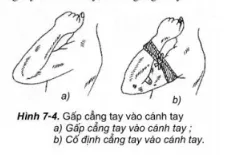 Lý thuyết GDQP 10 Kết nối tri thức Bài 12: Kĩ thuật cấp cứu và chuyển thương Ly Thuyet Bai 12 Ki Thuat Cap Cuu Va Chuyen Thuong 155914