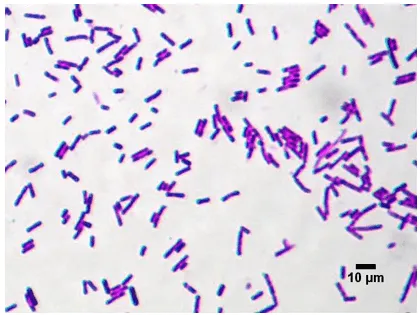 Vẽ và mô tả tóm tắt hình dạng các loại vi khuẩn em đã quan sát được Cau Hoi 4 Trang 41 Sinh Hoc 10 2