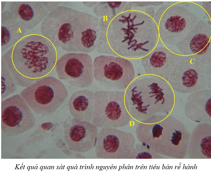 Sinh 10 Bài 18: Thực hành làm và quan sát tiêu bản quá trình nguyên phân và giảm phân | Giải Sinh học 10 (ảnh 1) Bai 18 Thuc Hanh Lam Va Quan Sat Tieu Ban Qua Trinh Nguyen Phan Va Giam Phan 132730