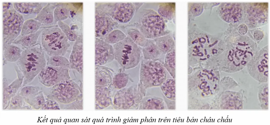 Sinh 10 Bài 18: Thực hành làm và quan sát tiêu bản quá trình nguyên phân và giảm phân | Giải Sinh học 10 (ảnh 1) Bai 18 Thuc Hanh Lam Va Quan Sat Tieu Ban Qua Trinh Nguyen Phan Va Giam Phan 132732