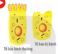 Hình bên cho thấy màng tế bào niêm mạc ruột non bình thường có diện tích lớn (ảnh 1) Mo Dau Trang 48 Sinh Hoc 10 132559
